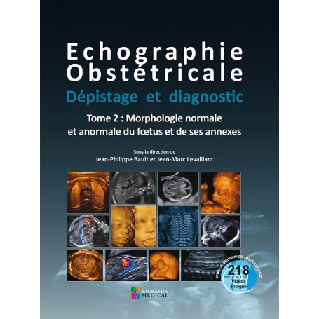 Echographie obstétricale, tome 2
