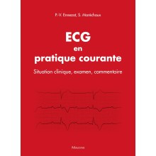 ECG en pratique courante