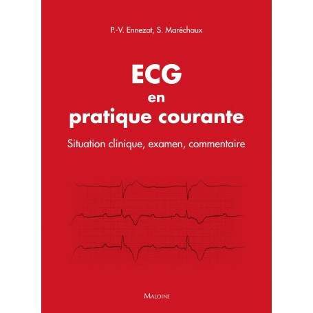 ECG en pratique courante