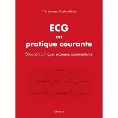 ECG en pratique courante