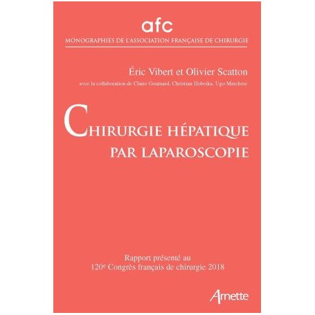 Chirurgie hépatique par laparoscopie