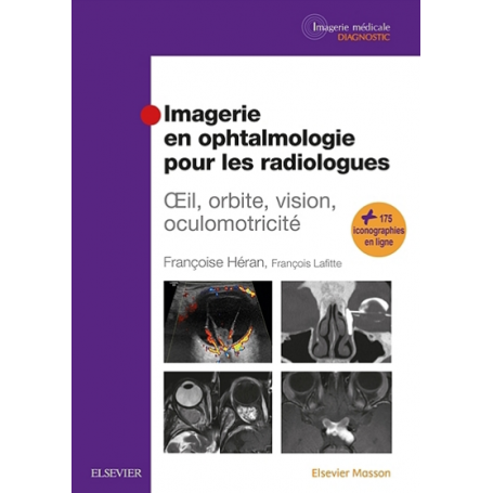 Imagerie en ophtalmologie pour les radiologues