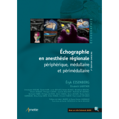 Echographie en anesthésie régionale