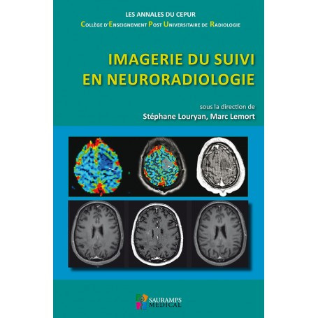 Imagerie de suivi en neuroradiologie