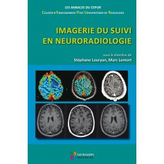 Imagerie de suivi en neuroradiologie